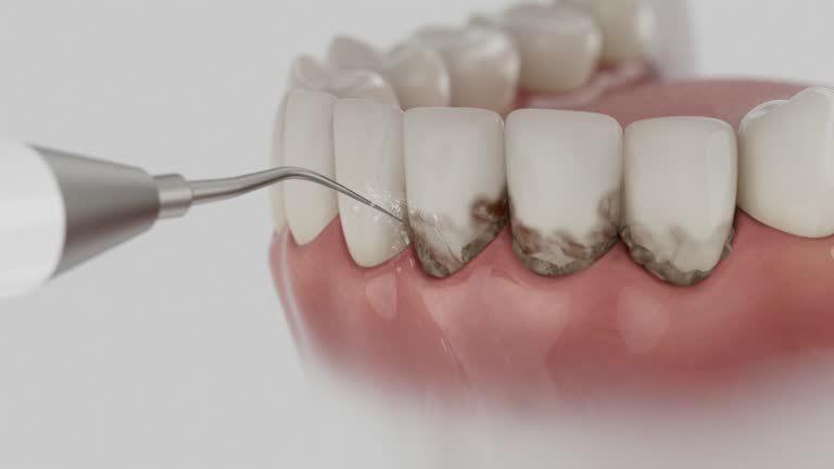 Reliable Dental Implants contractor in Winnebago, MN by Smile Center Dentistry